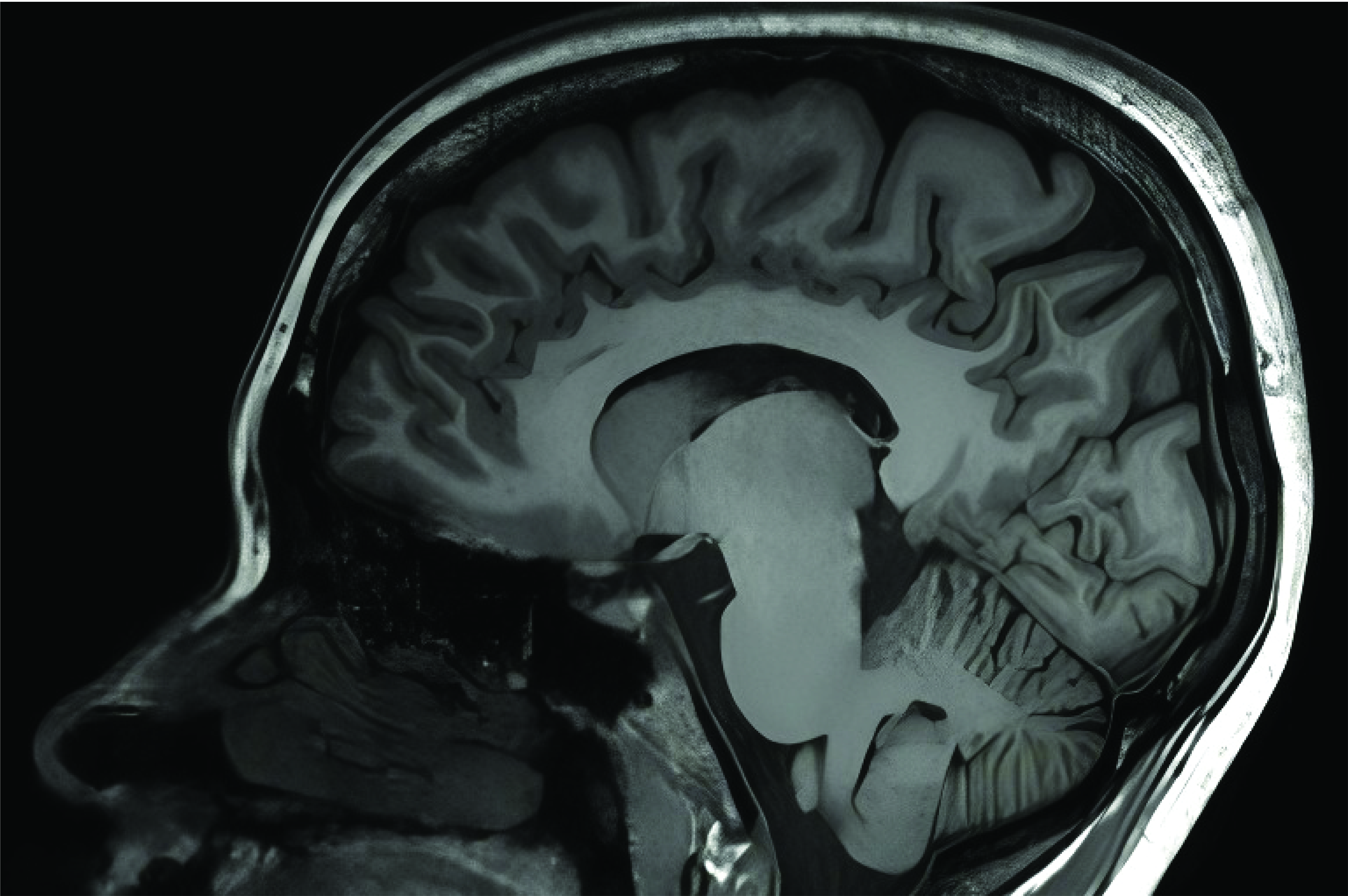 Scientists sometimes use Magnetic Resonance Imaging (MRI) scans to look into the brain's structures and functions to understand different aspects of consciousness (Image courtesy: Swagata Halder, Cognition Lab, CNS, IISc)